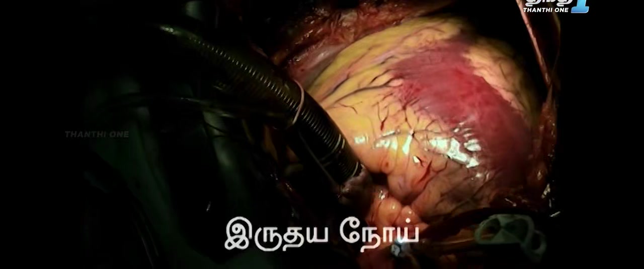 isaimini.Tube - Yegathipathi 2024 Original 720p HD (700MB).mp4