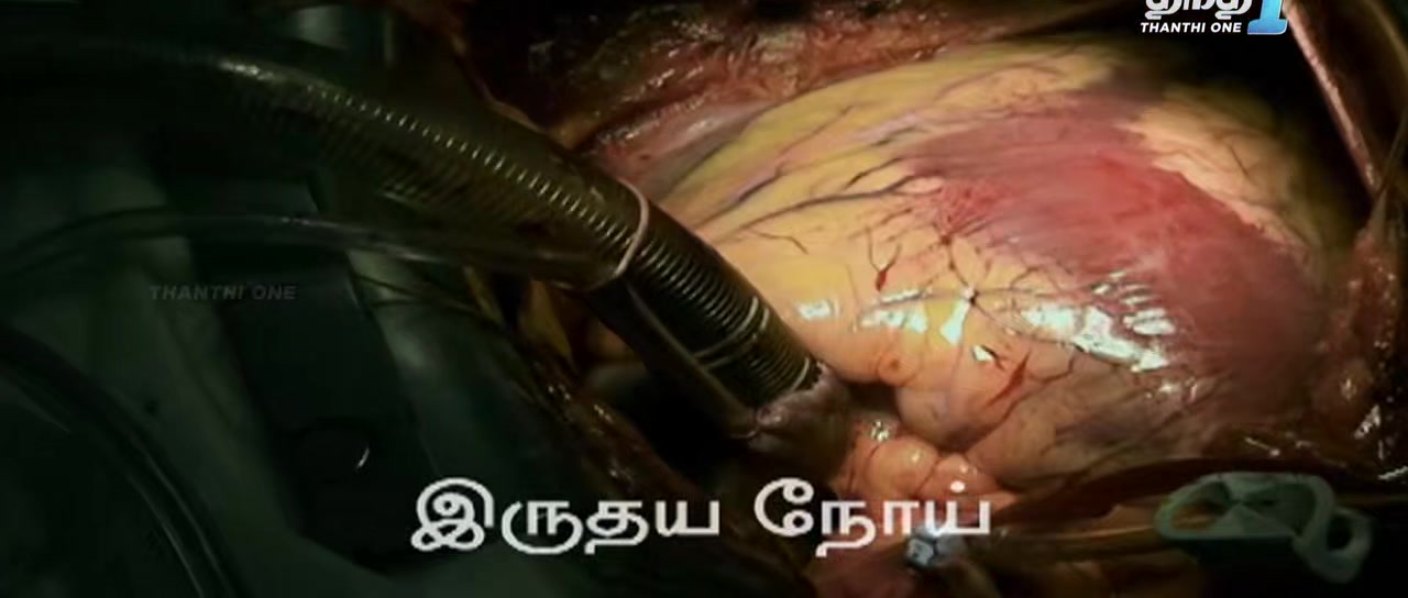 isaimini.Tube - Iru Vizhi Oru Paarvai 2024 Original 720p HD (800MB).mp4