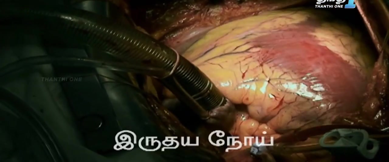 isaimini.Tube - Iru Vizhi Oru Paarvai 2024 Original 720p HD.mp4